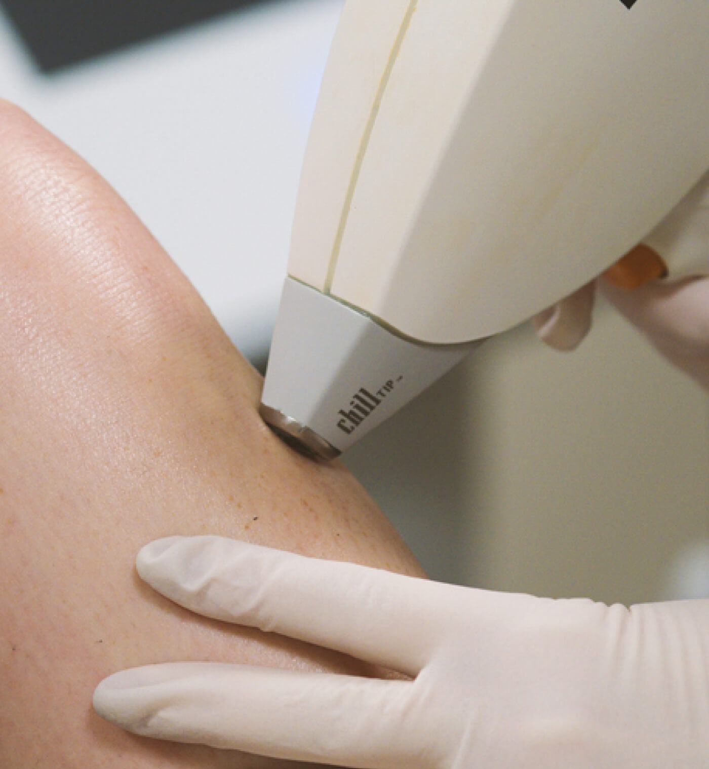 North_Idaho_Dermatology_Medical_and_Cosmetic_Skin_Care_sub-banner-45 1
